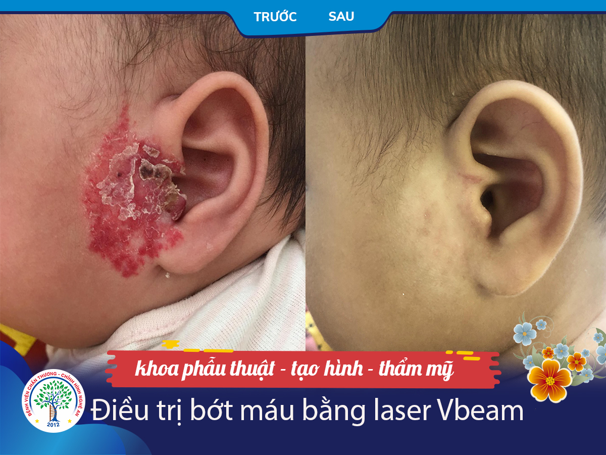 Nguyễn Thái Bảo