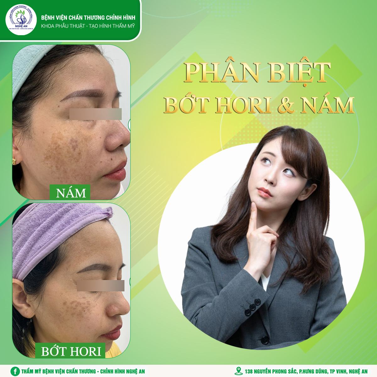 PHÂN BIỆT BỚT HORI VÀ NÁM