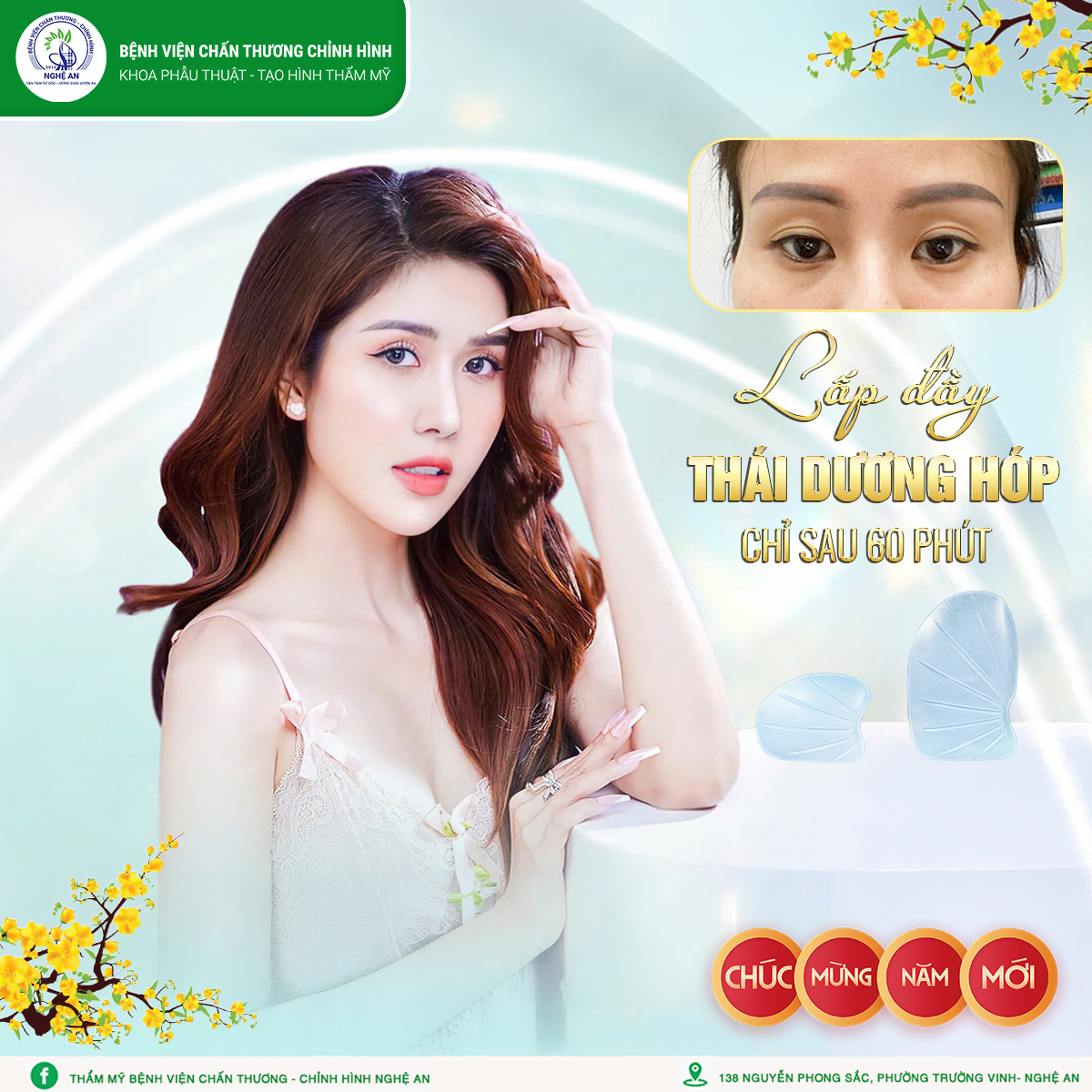 ĐỘN THÁI DƯƠNG – LÀM MỘT LẦN, ĐẸP DÀI LÂU!